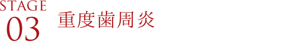 保護ダム作成（歯茎保護のための前処置）